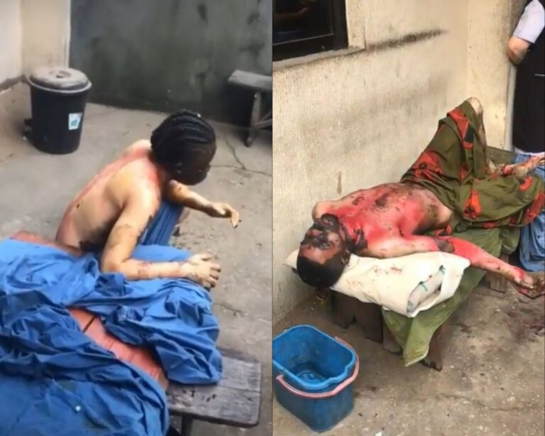 SHOCKING! Woman engulfed in fire after setting ex-boyfriend ablaze in Abia (photos + videos) 