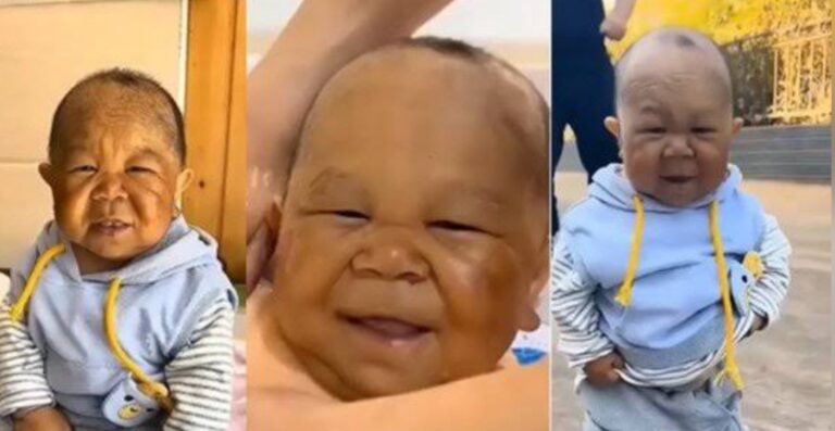 Born Different: Meet 29-year-old baby man that never grew