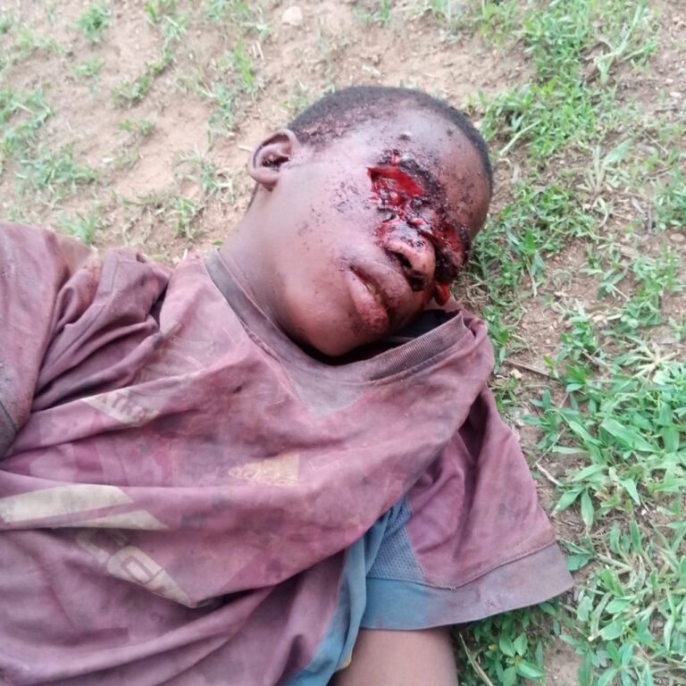 Boy with his 2 eyes plucked found in pool of blood in Bauchi (Gory Photos)