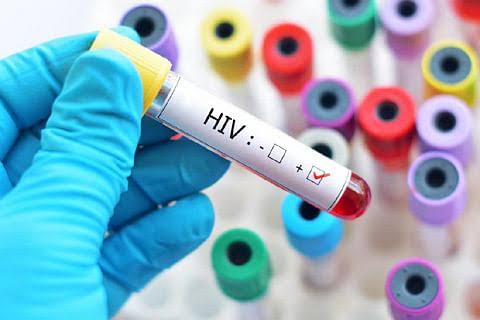 HIV infections in Nigeria drop by 22 percent in 6 years – WHO