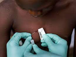 From COVID to MonkeyPox: Can Nigeria afford another epidemic?, by Gift Luckson