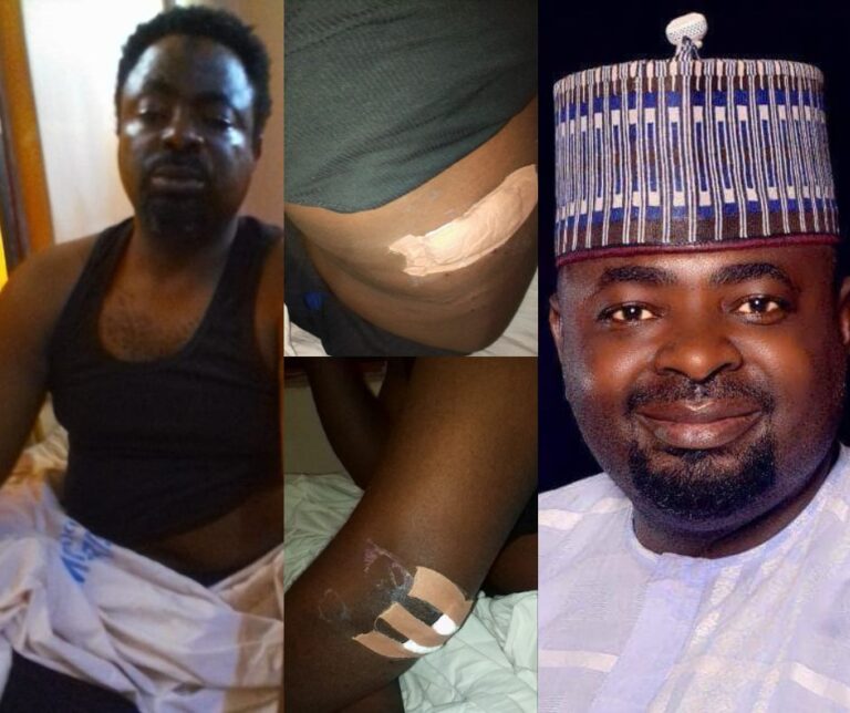 Former Nasarawa commissioner survives assassination attempt (Photos)