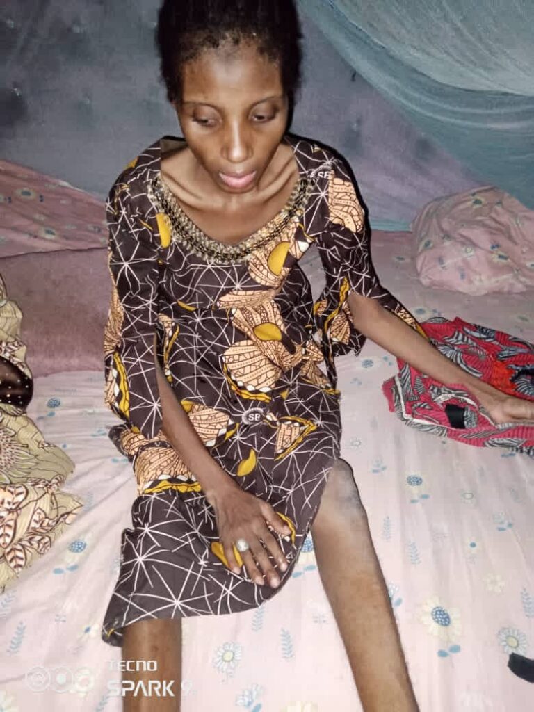 Police in Yobe arrests man for locking up, starving wife for one year