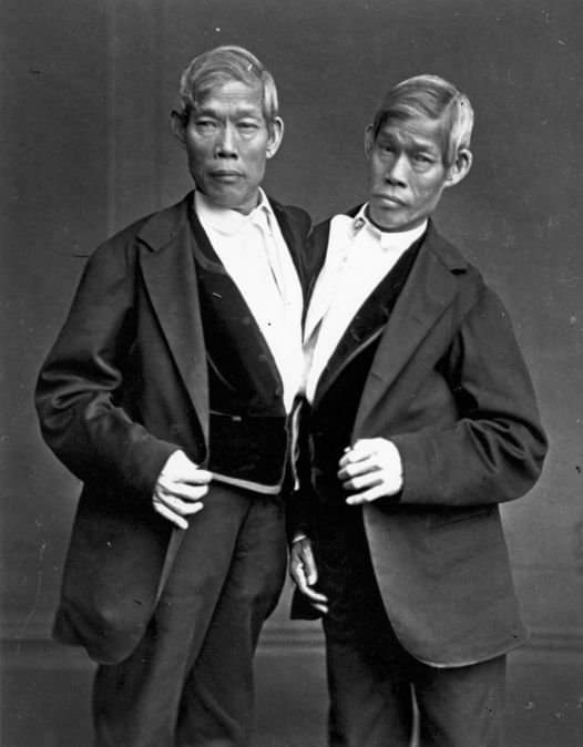 Place of Cheng and Eng (1881 – 1874) in the phrase: ‘Siamese twins’