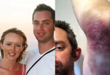 How British man wore make-up to hide bruises from wife’s beating for 20 years