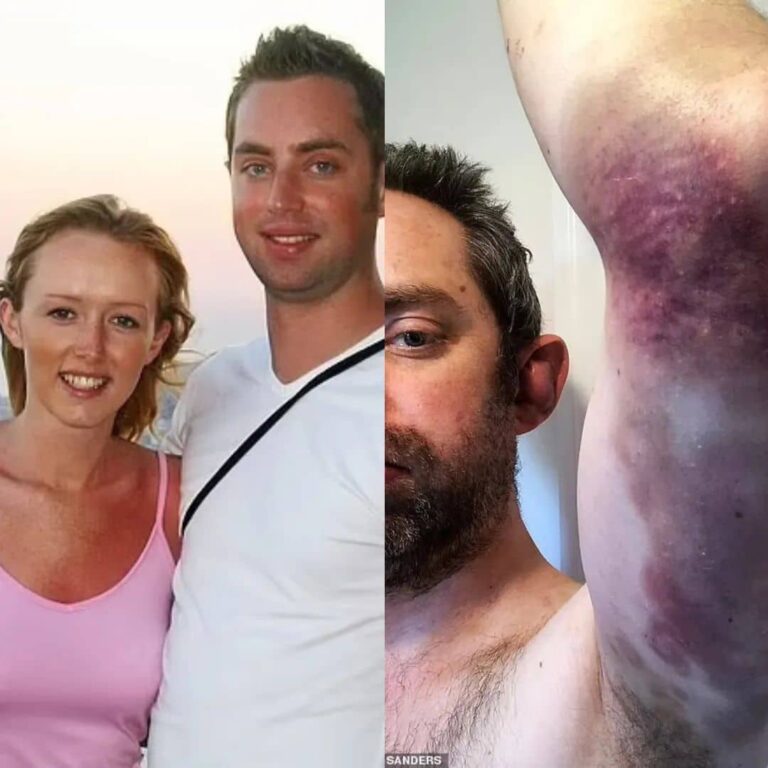 How British man wore make-up to hide bruises from wife’s beating for 20 years