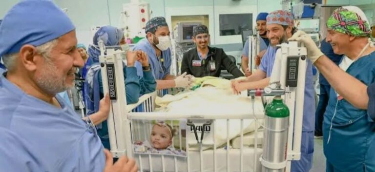 Saudi surgeons successfully separate Nigerian conjoined twins after 14-hour operation