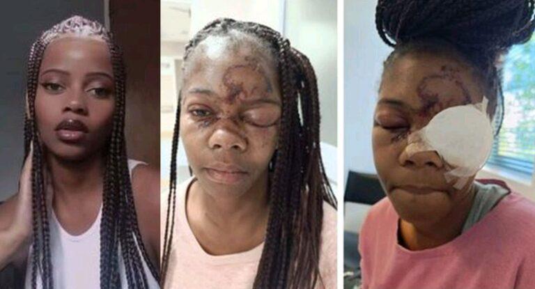 Angry man blinds lady's left eye for rejecting his love advances