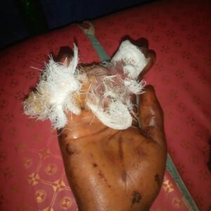 Police arrest phone snatcher in Abuja for cutting off teenager's fingers 