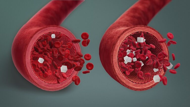 Understanding Hypoglycemia: Causes, symptoms, and life-saving treatment, by Maryam Sulaiman