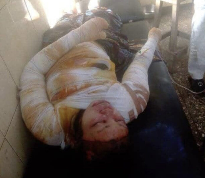 Woman reportedly dies after setting self ablaze in Bauchi