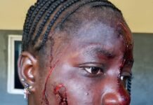 Taraba woman attacks teenager with razor over alleged affair with husband